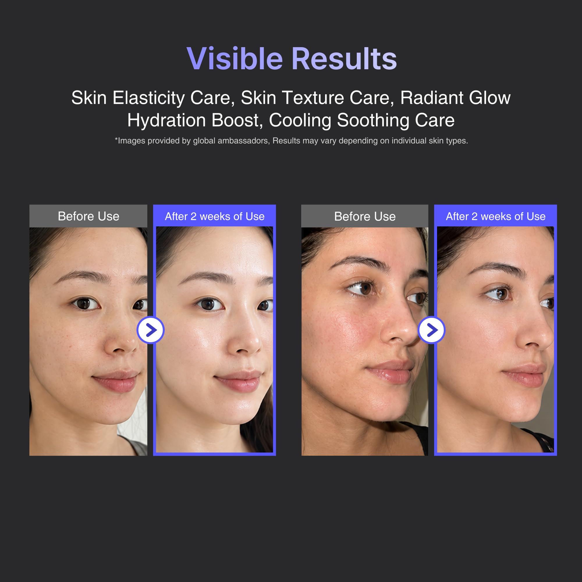 Amazon.com: glow.m Cryo Sonic Pro with Moisture Booster Gel (100g